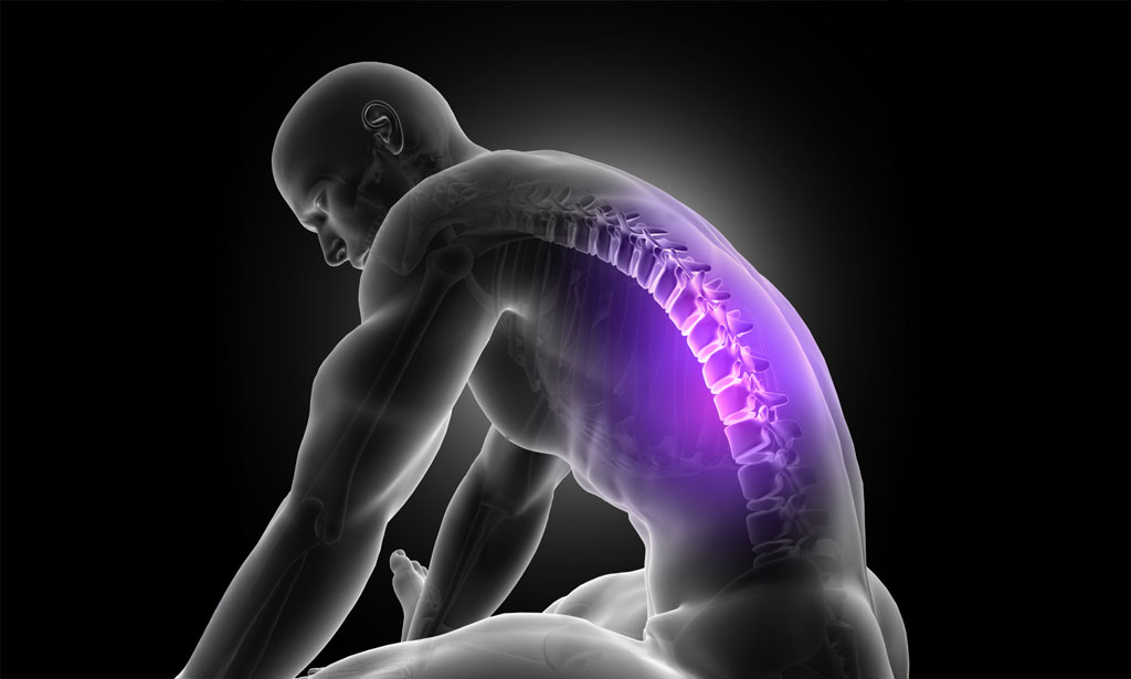 Chiropractic Care - Back injury due to auto accident