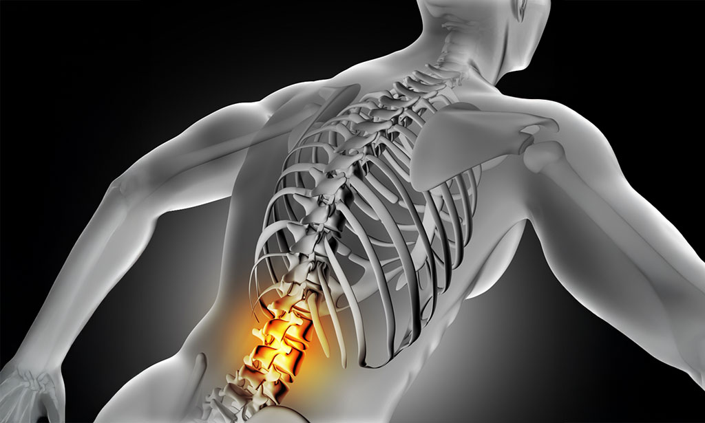 Chiropractic Care - Lower Back Pain